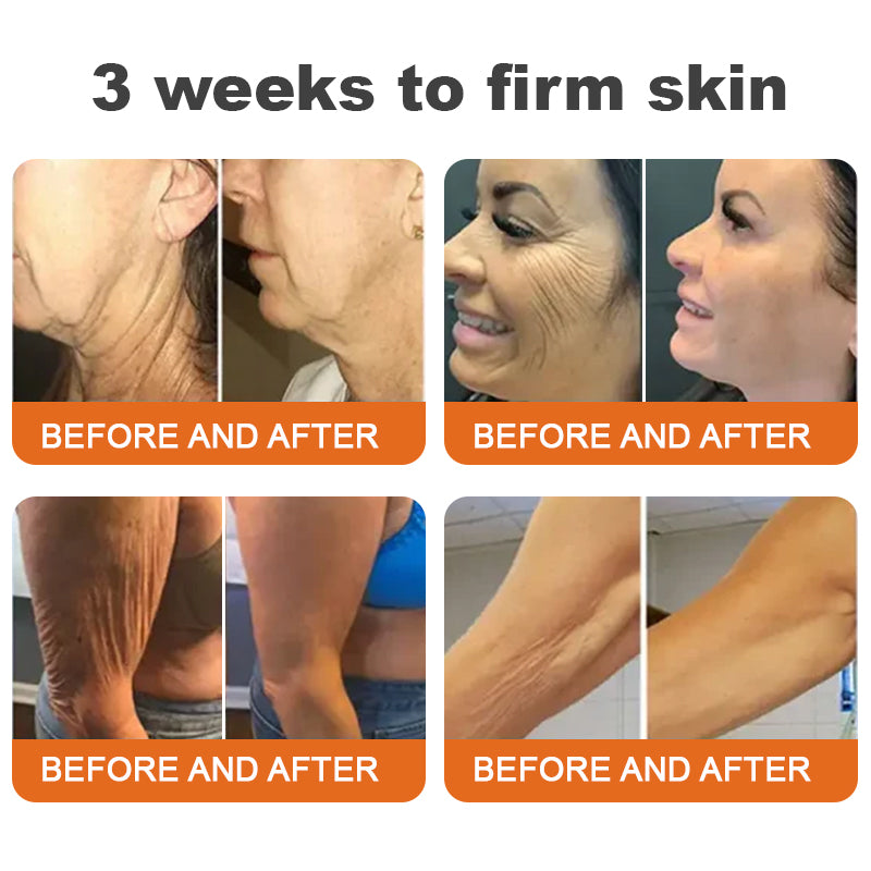 💫Made and Shipped from UK🇬🇧 Rolimey® Argireline-infused Bee Venom Firming Serum Stick(⏳LAST DAY 70% OFF)✨