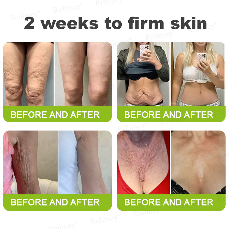 ✨ 1pc - Wrinkle Trial