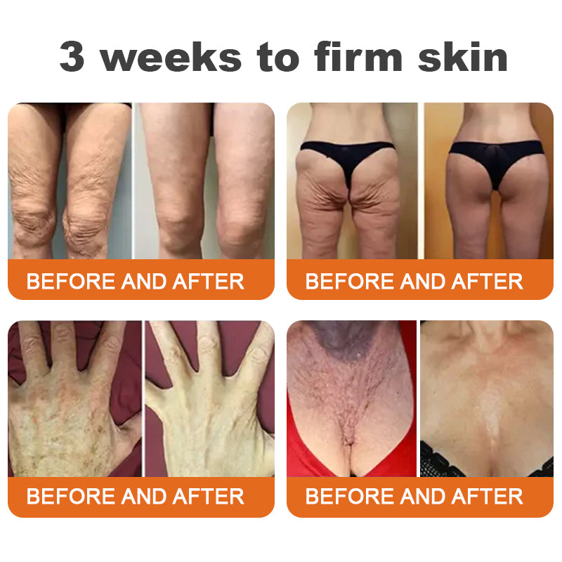 💫Made and Shipped from UK🇬🇧 Rolimey® Argireline-infused Bee Venom Firming Serum Stick(⏳LAST DAY 70% OFF)✨
